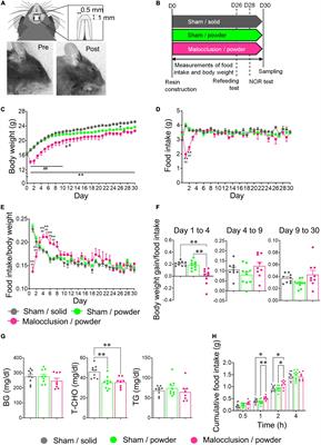 Malocclusion impairs cognitive behavior via AgRP signaling in adolescent mice